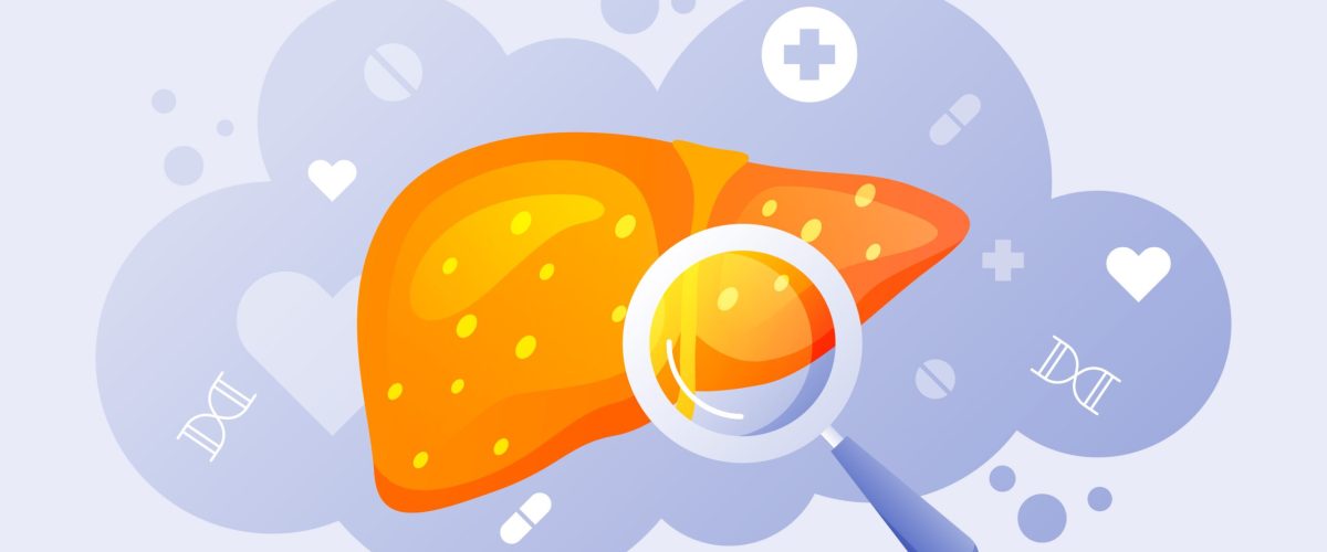 orlistate e gordura no fígado