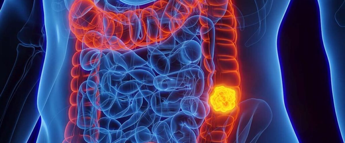 WhatsApp Image 2026-03-26 at 22.18.31