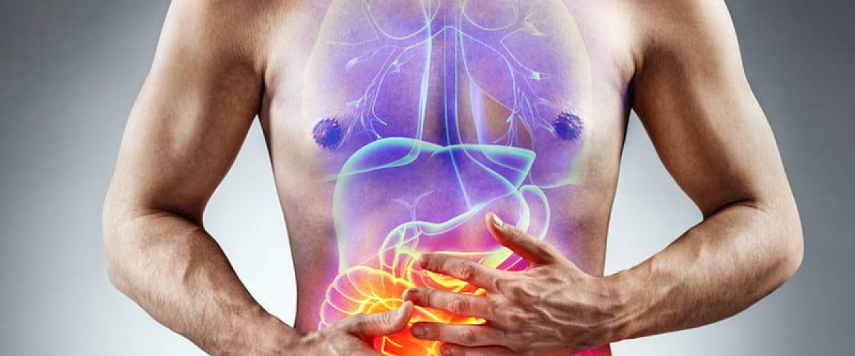 post 4 - infarto intestinal