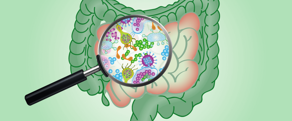 Supercrescimento Bacteriano (SIBO): Tratamento E Diagnóstico - Clínica ...